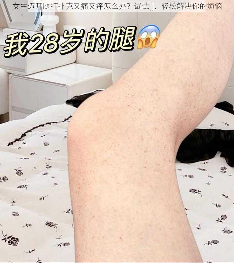 女生迈开腿打扑克又痛又痒怎么办？试试[]，轻松解决你的烦恼