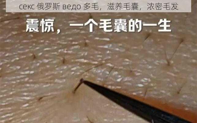 секс 俄罗斯 ведо 多毛，滋养毛囊，浓密毛发