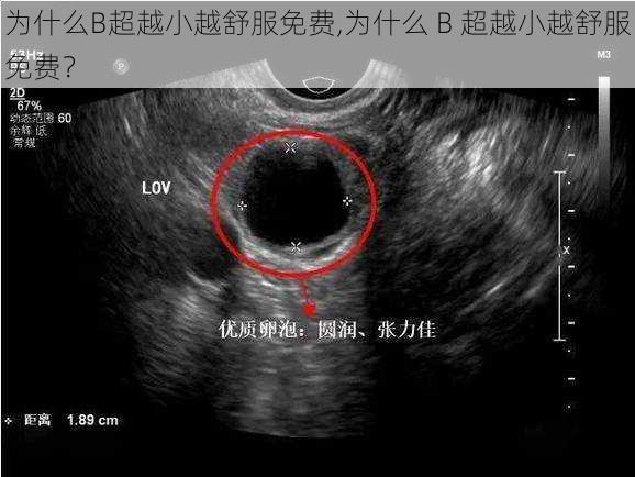 为什么B超越小越舒服免费,为什么 B 超越小越舒服免费？