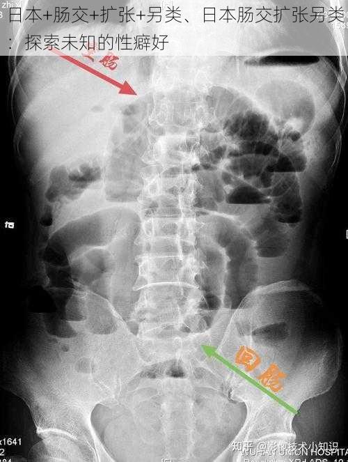 日本+肠交+扩张+另类、日本肠交扩张另类：探索未知的性癖好