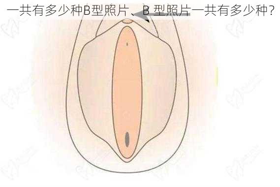 一共有多少种B型照片、B 型照片一共有多少种？